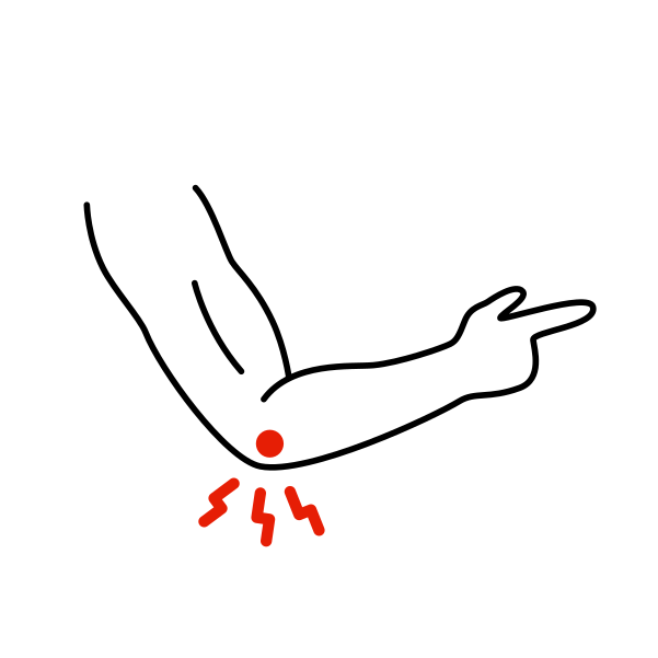 armbåge naprapat stockholm