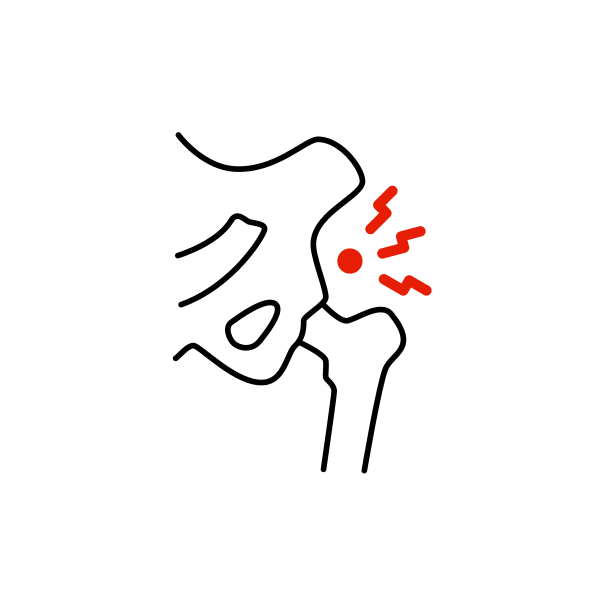 höftproblem naprapat vasastan